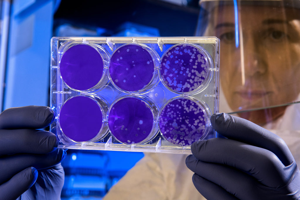 How do Probiotics work?